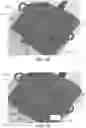 Fig. 14 - Methods and apparatus for patient positioning in magnetic resonance imaging