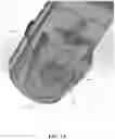 Fig. 17 - Methods and apparatus for patient positioning in magnetic resonance imaging