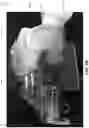 Fig. 22 - Methods and apparatus for patient positioning in magnetic resonance imaging