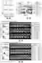 Fig. 07 - Dynamic 129Xe gas exchange spectroscopy
