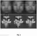 Fig. 05 - Deception detection system and method