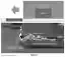 Fig. 07 - SYSTEM, DEVICE AND METHOD FOR BLADDER VOLUME SENSING
