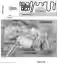 Fig. 19 - SYSTEM, DEVICE AND METHOD FOR BLADDER VOLUME SENSING