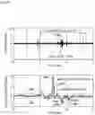 Fig. 14 - Swallowing sensor