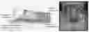 Fig. 01 - Real-time parathyroid imaging device