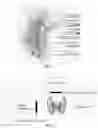Fig. 03 - Real-time parathyroid imaging device