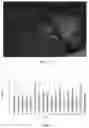Fig. 07 - Real-time parathyroid imaging device