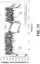 Fig. 10 - Wireless bowel sensor