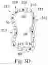 Fig. 07 - Estimation of effectiveness of ablation adjacency