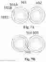 Fig. 13 - Estimation of effectiveness of ablation adjacency