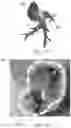 Fig. 20 - Estimation of effectiveness of ablation adjacency