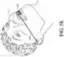 Fig. 23 - SYSTEMS, DEVICES, AND METHODS FOR TRACKING AND COMPENSATING FOR PATIENT MOTION DURING A MEDICAL IMAGING SCAN
