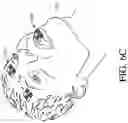 Fig. 25 - SYSTEMS, DEVICES, AND METHODS FOR TRACKING AND COMPENSATING FOR PATIENT MOTION DURING A MEDICAL IMAGING SCAN