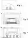 Fig. 03 - X-ray imaging with x-ray markers that provide adjunct information but preserve image quality