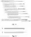 Fig. 14 - X-ray imaging with x-ray markers that provide adjunct information but preserve image quality