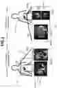 Fig. 02 - SYSTEM AND METHOD FOR PROCESSING DATA FROM COMPUTED TOMOGRAPHY SCANS