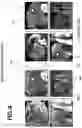 Fig. 05 - SYSTEM AND METHOD FOR PROCESSING DATA FROM COMPUTED TOMOGRAPHY SCANS
