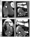 Fig. 06 - SYSTEM AND METHOD FOR PROCESSING DATA FROM COMPUTED TOMOGRAPHY SCANS