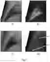 Fig. 08 - System and method for dark-field-imaging