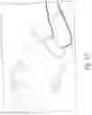 Fig. 35 - Ultrasound patch for detecting fluid flow