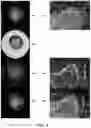 Fig. 06 - Waveform enhanced reflection and margin boundary characterization for ultrasound tomography
