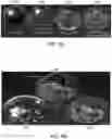 Fig. 08 - Waveform enhanced reflection and margin boundary characterization for ultrasound tomography