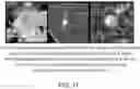 Fig. 13 - Waveform enhanced reflection and margin boundary characterization for ultrasound tomography