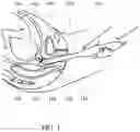 Fig. 02 - METHOD AND PROBE FOR PREDICTING SPONTANEOUS PRETERM DELIVERY