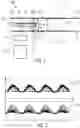 Fig. 02 - Intravascular doppler ultrasonic device and method for controlling its operation