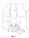 Fig. 02 - Medical probe, assembly and method