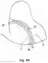 Fig. 05 - Medical probe, assembly and method