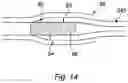 Fig. 11 - Medical probe, assembly and method