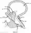 Fig. 20 - Expandable tissue engagement apparatus and method