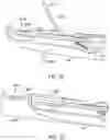 Fig. 21 - Expandable tissue engagement apparatus and method