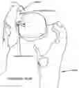 Fig. 01 - Method and apparatus for re-attaching the labrum to the acetabulum, including the provision and use of a novel suture anchor system