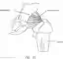 Fig. 13 - Method and apparatus for re-attaching the labrum to the acetabulum, including the provision and use of a novel suture anchor system