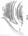 Fig. 19 - Method and apparatus for re-attaching the labrum to the acetabulum, including the provision and use of a novel suture anchor system