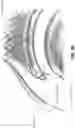 Fig. 24 - Method and apparatus for re-attaching the labrum to the acetabulum, including the provision and use of a novel suture anchor system
