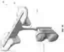 Fig. 69 - Method and apparatus for re-attaching the labrum to the acetabulum, including the provision and use of a novel suture anchor system