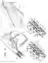 Fig. 04 - Post-Implantation Tension Adjustment in Cardiac Implants