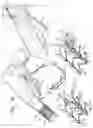 Fig. 05 - Post-Implantation Tension Adjustment in Cardiac Implants