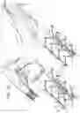 Fig. 07 - Post-Implantation Tension Adjustment in Cardiac Implants