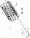 Fig. 08 - Tissue anchors with hemostasis seal
