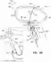 Fig. 16 - Tissue anchors with hemostasis seal