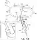 Fig. 18 - Tissue anchors with hemostasis seal