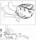 Fig. 27 - Tissue anchors with hemostasis seal