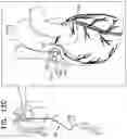 Fig. 28 - Tissue anchors with hemostasis seal