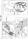 Fig. 33 - Tissue anchors with hemostasis seal