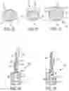 Fig. 06 - Devices, systems, and methods for anchoring sutures