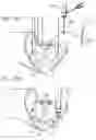 Fig. 12 - Knotless suture fastener installation system